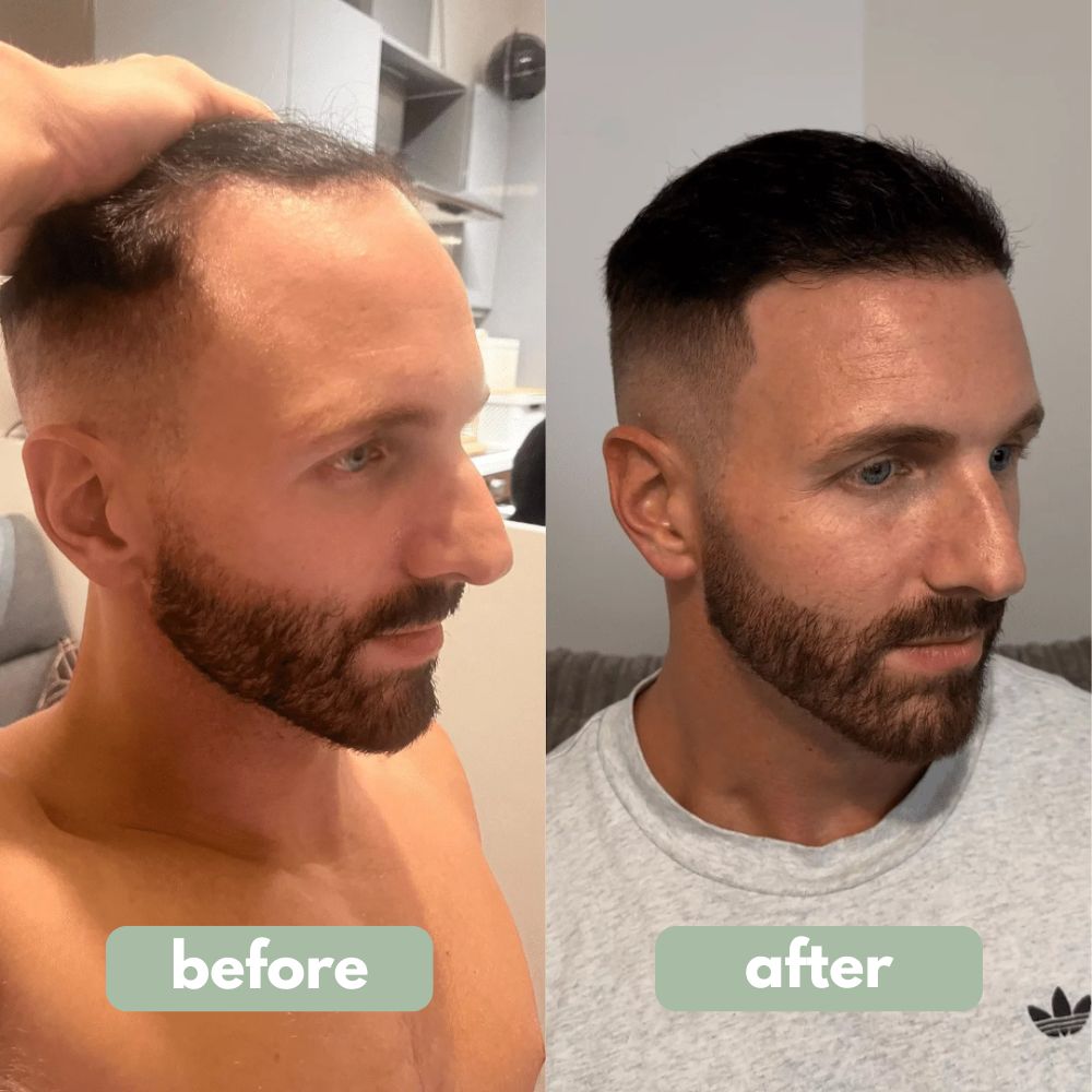 MRGROWTH™ Hair Density Roll-On Serum